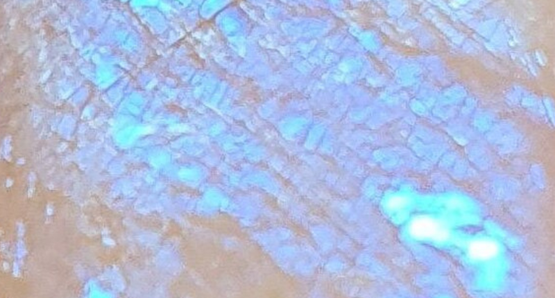 pierre péristérite